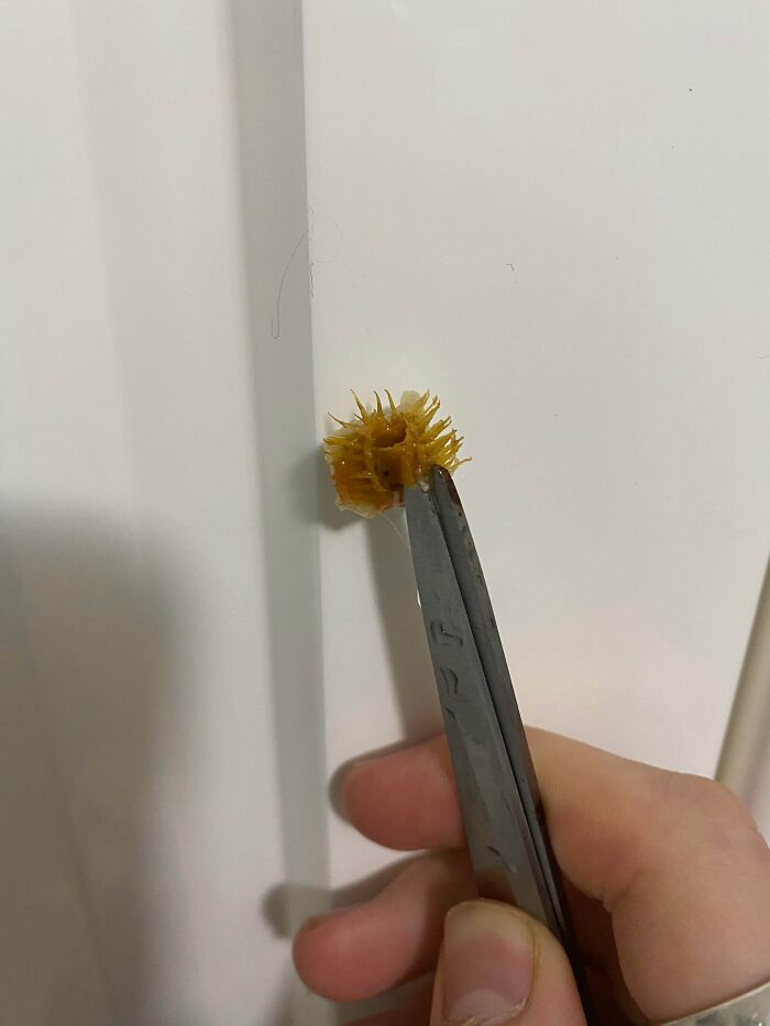 What Is This Thing? I Found It In A Frozen Meal. It’s Sharp And Hard, Spiky, And Brown-Ish Coloured