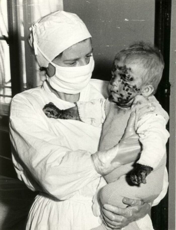 Enfermera con un niño enfermo durante un brote de viruela, Wrocław, Polonia, 1963