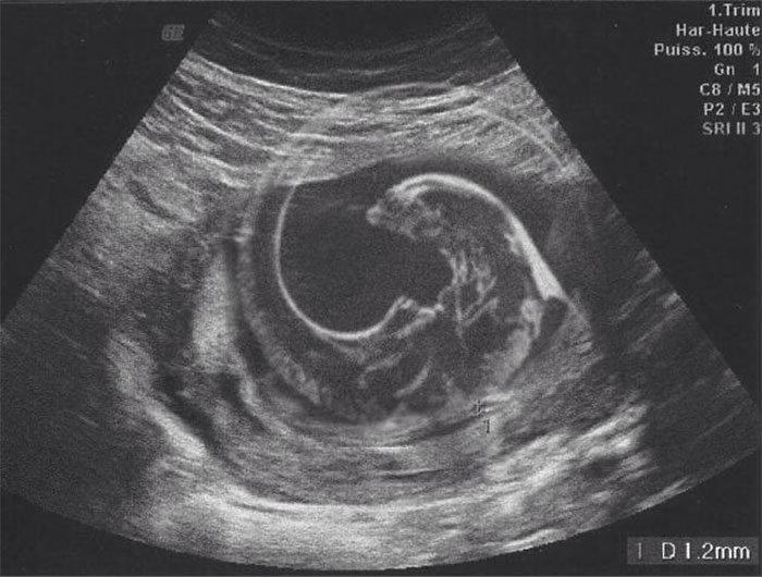 Cuando a mi esposa le hicieron un ultrasonido de nuestro primer hijo, hice una foto para que la pudiera enviar a la familia