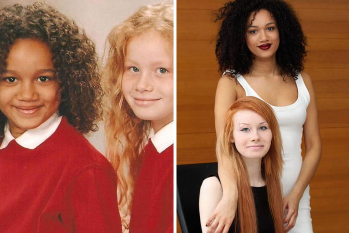 Biracial Twin Sisters Born To A White Father And A Half-Jamaican Mother