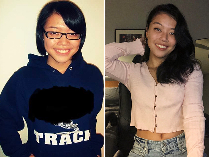 17 To 26 - I Kept That Bob For 7 Years Unfortunately. Got Lasik, Cleared Up The Acne And Gained Confidence