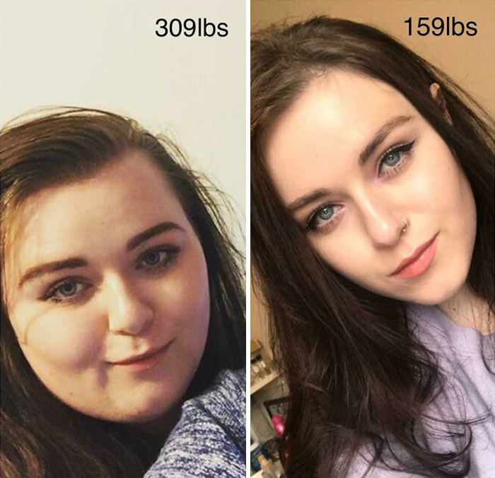 Face Gains! I’ve Decided To Stop Actively Trying To Lose Weight Now And Focus On Maintaining After Being Told By The Doctor That I’m Healthy All Round! It’s So Nice To Have My Jawline Back Finally