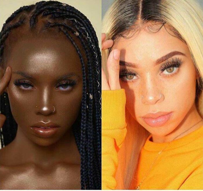 Right Is Her Natural Skin Colour, Left Is.... Yikes