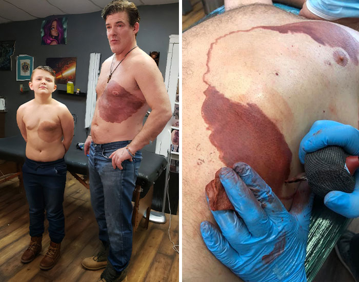 Dad Sits For 30 Hours Straight To Get Identical Tattoo To His 8-Year-Old’s Birthmark