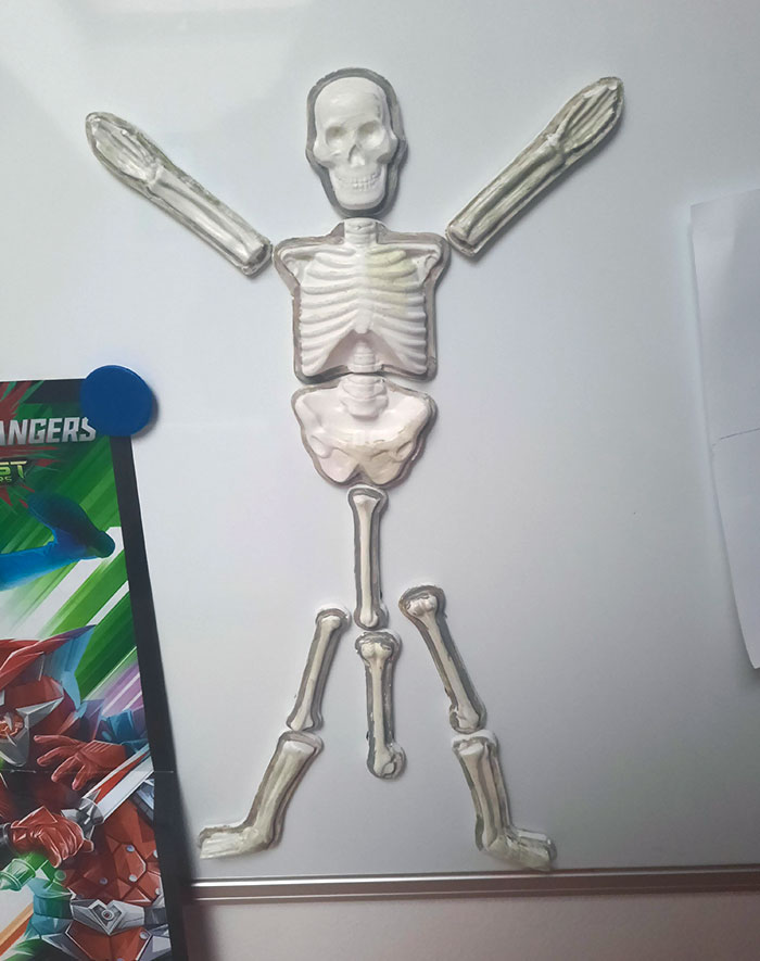 This Is The Skeleton My Younger Brother Built