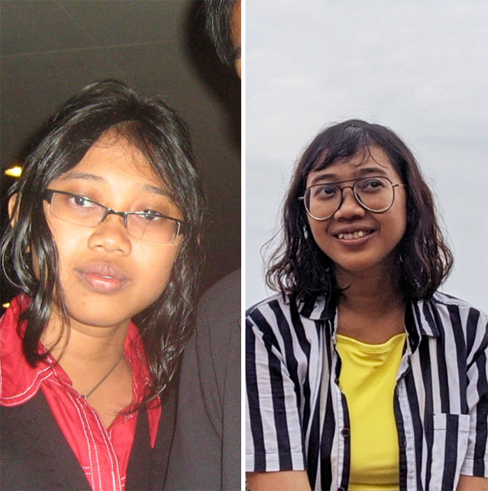 This Is 10 Years Differences. I Used Not To Smile In My Old Photo Because Of Crooked Teeth
