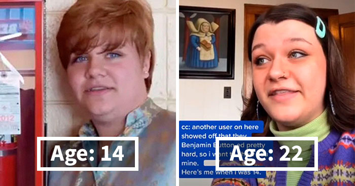 23 People Share How They Somehow Managed To Reverse Age Like Benjamin Button