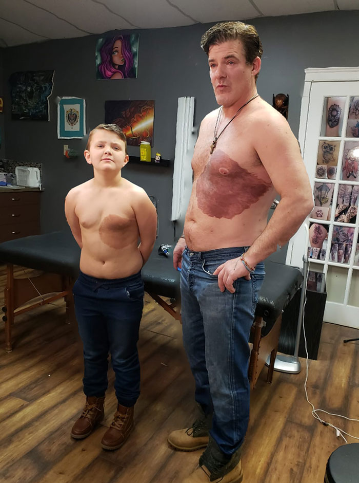 Derek Prue Sr., A Dad From Alberta, Sat Through 30 Hours Of Tattoo Pain So That His Son Would Feel Better About His Birthmark