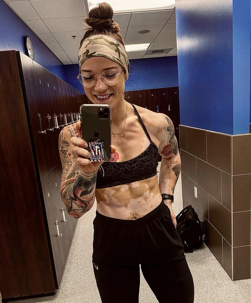 This Woman From Utah Learned To Accept Her Vitiligo Through Fitness And Weightlifting