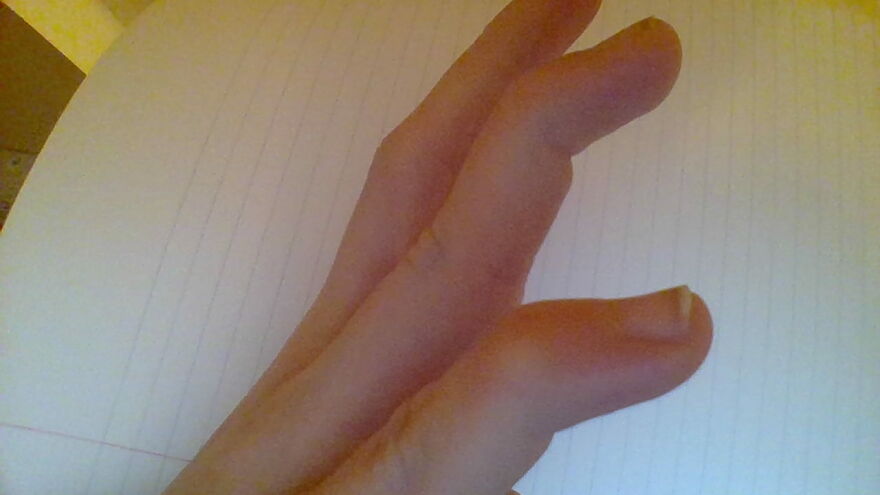 All Of My Fingers Are Double Jointed On Both Joints And I Cant Take A Pic But I Can Also Touch My Thumb To My Wrist In Both Directions On Both Hands.