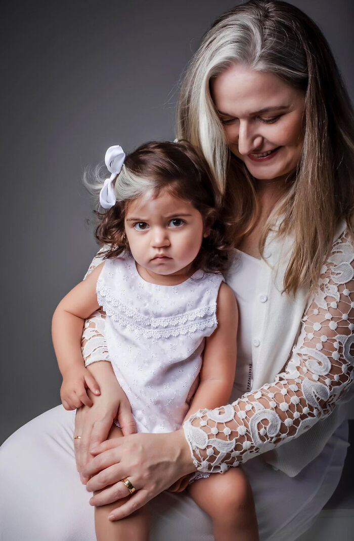 Mother Encourages Her Two-year-old Who Was Born With A White Streak In Her Hair To Embrace Her Uniqueness