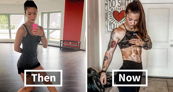 This Woman From Utah Learned To Accept Her Vitiligo Through Fitness And Weightlifting