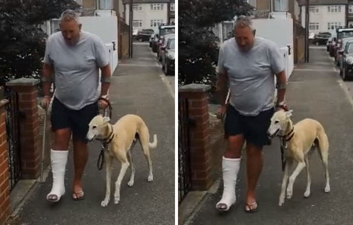 Injured Dog Owner Spends $400 On Vet For His Limping Dog Only To Find Out He Was Copying The Owner Out Of Sympathy