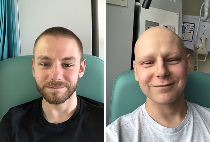 La diferencia de tres meses de quimioterapia dura