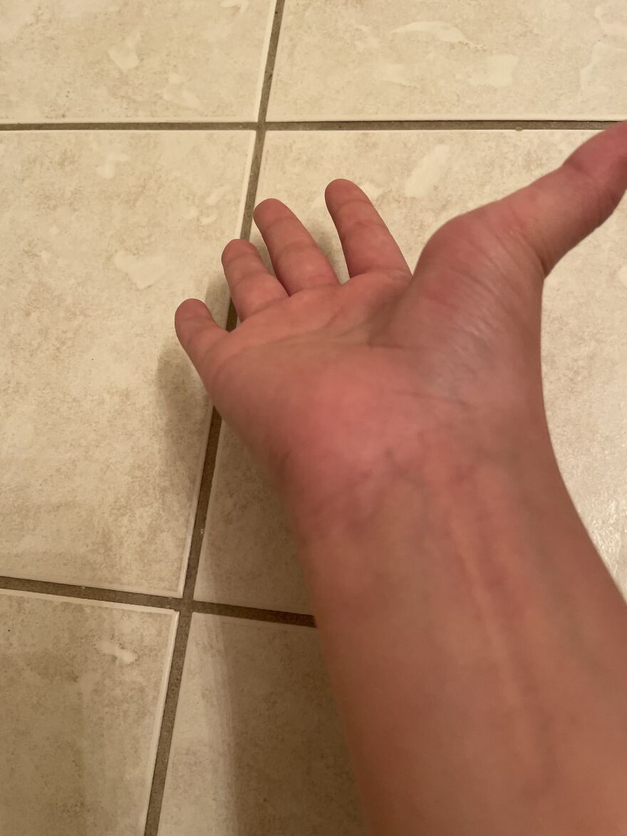 I Don’t Know If This Counts But My Thumb Can Do This
