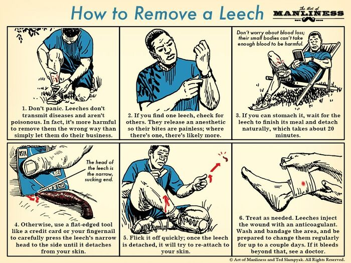 How To Remove A Leech