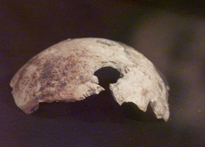 El cráneo de Hitler era falso, o era el cráneo de otra persona