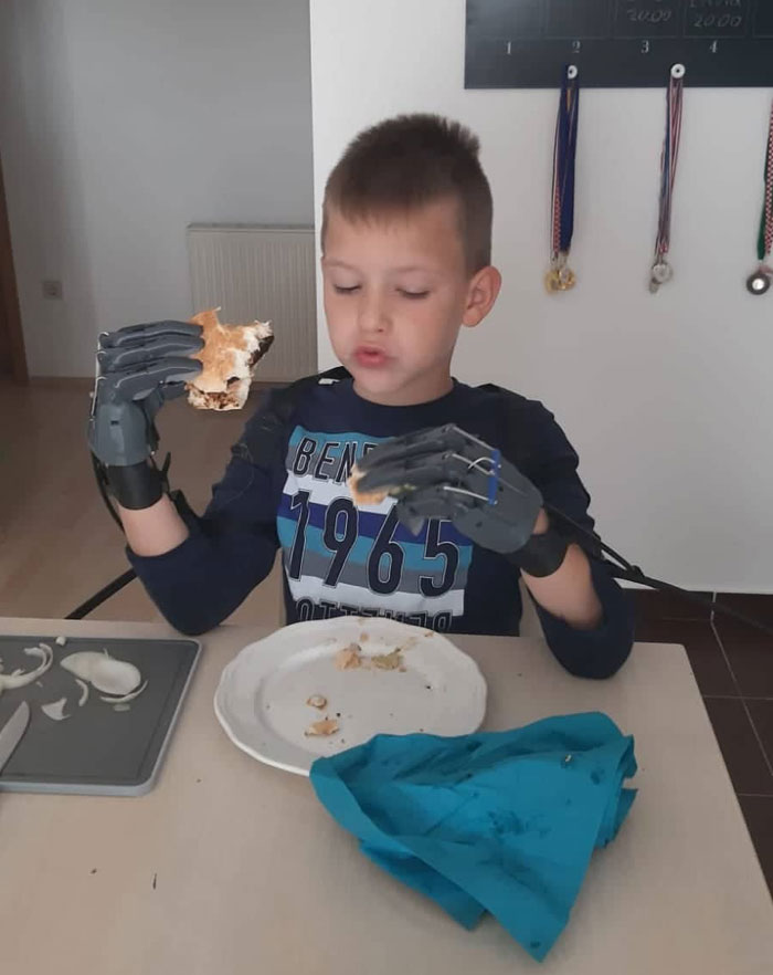 My Friend Eating A Burger With Prosthetic Hands I Designed And Built For Him