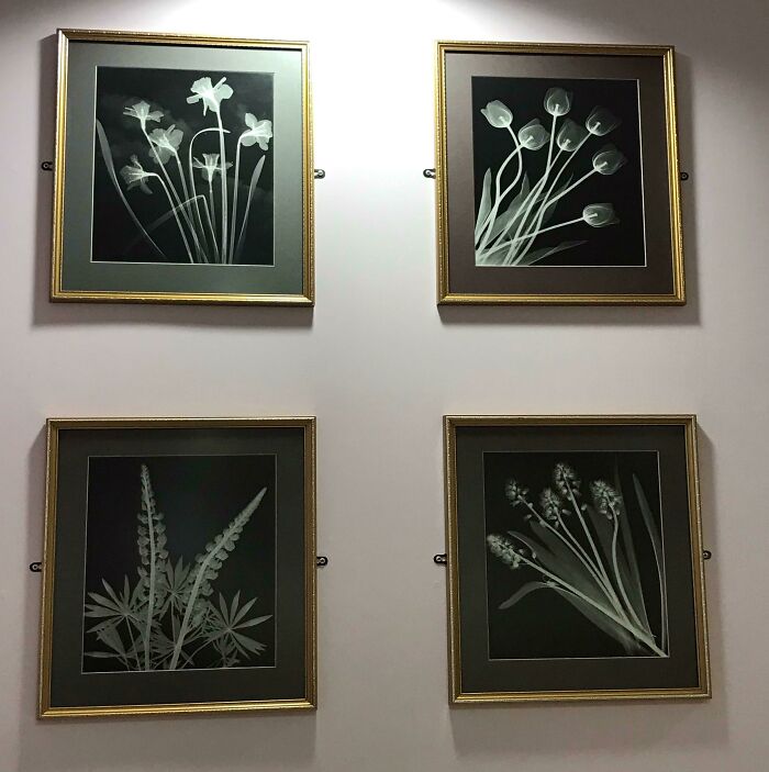 The Radiology Waiting Room In Local Hospital Has The Usual Naff Floral Decor, Except... They’re X-Rays