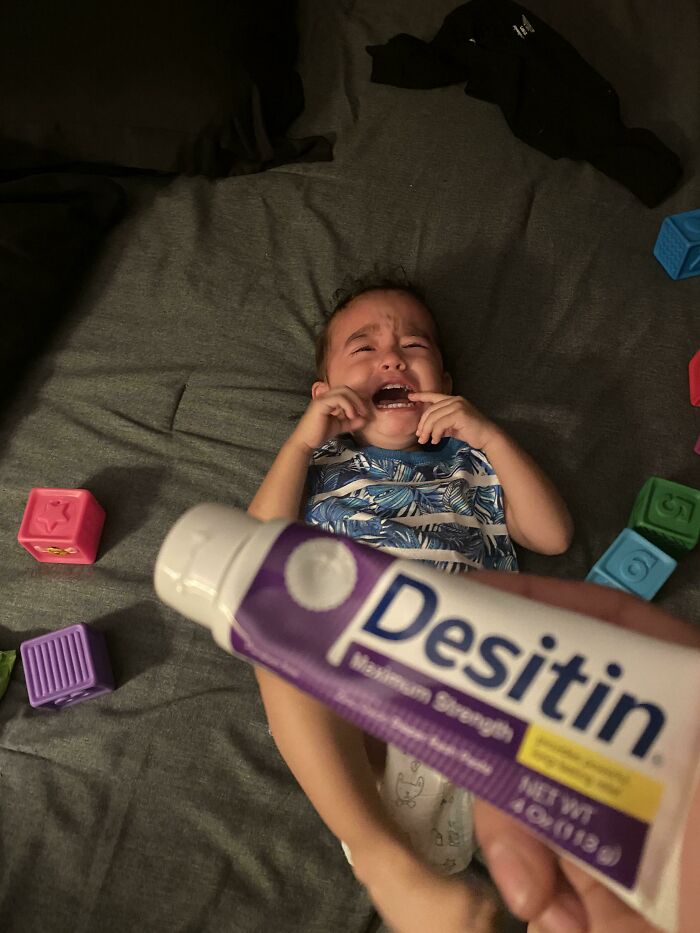 My 1.5 Year Old Breaking Down Because I Won’t Allow Him To Eat The Diaper Rash Cream Before Bed Time