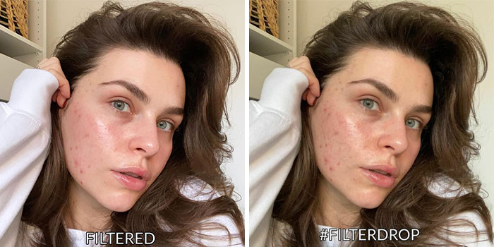 Women Join The #FilterDrop Challenge On Instagram, Share 22 Unfiltered Faces To Fight Against Retouched Paid Beauty Ads