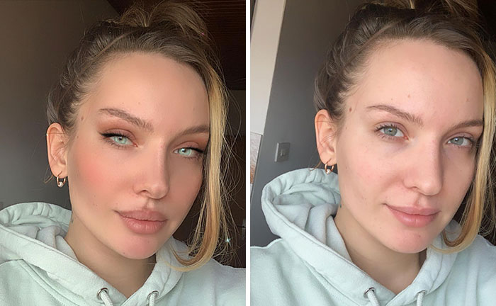 Women Join The #FilterDrop Challenge On Instagram, Share 22 Unfiltered Faces To Fight Against Retouched Paid Beauty Ads