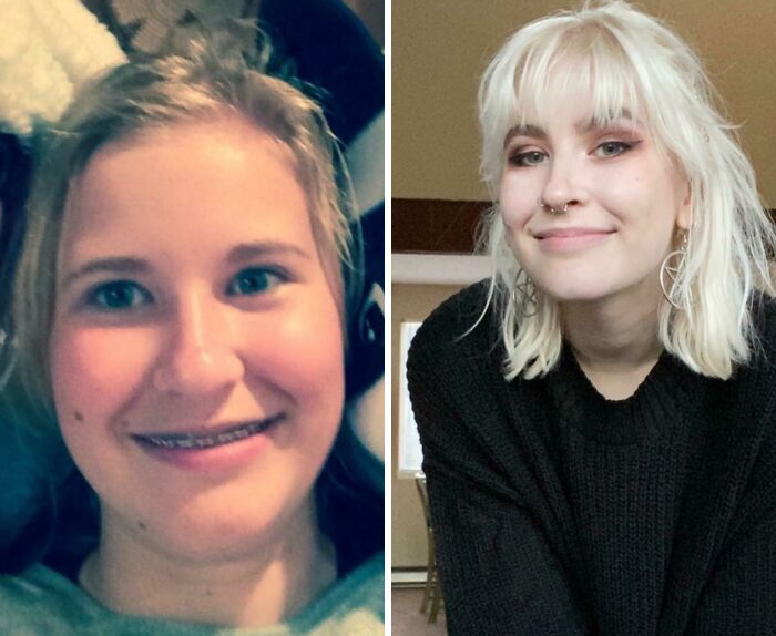 14 To 20 Because People Said My Resting Face Was Angry