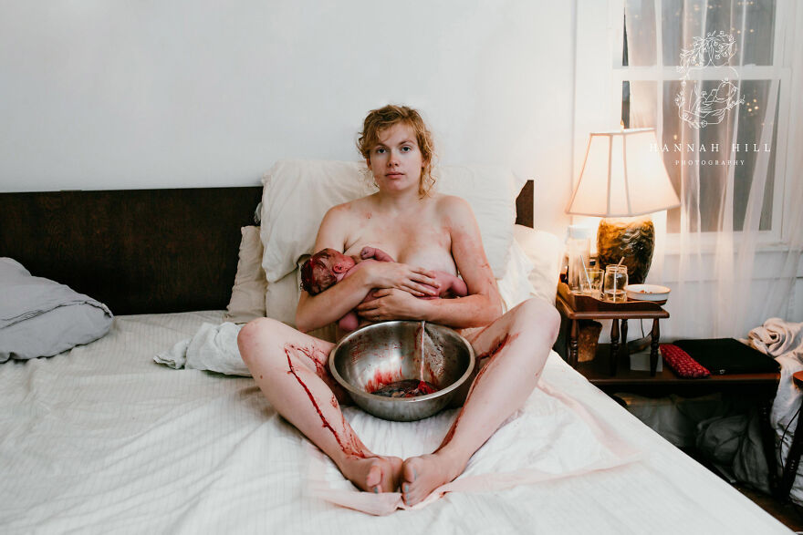 Best In Postpartum: "My Body, My Birth" By Hanna Hill, United States