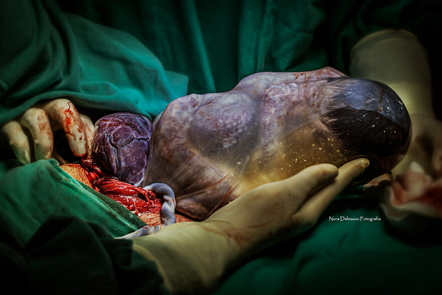 Honorable Mention: "The Miracle Of Life In Your Hands" By Nora Dalmasso, Argentina