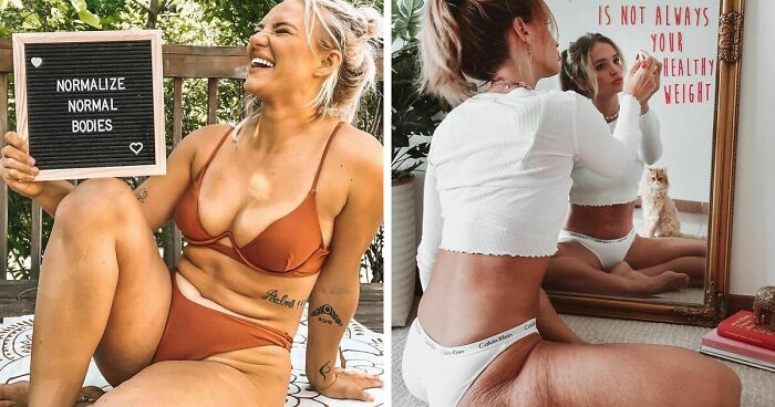41 Women Post Unedited Pics To “Normalize Normal Bodies” | Bored Panda