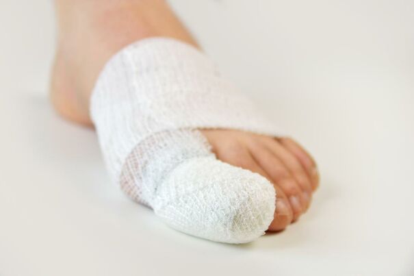 broken-big-toe-wrapped-in-bandages-60254c170f5f7.jpg