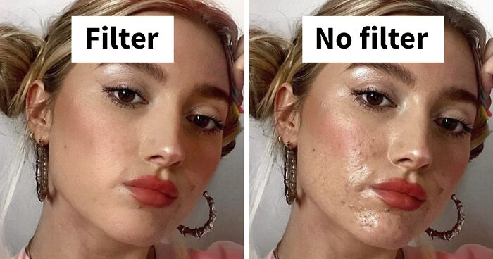 Women Join The #FilterDrop Challenge On Instagram, Share 22 Unfiltered  Faces To Fight Against Retouched Paid Beauty Ads | Bored Panda