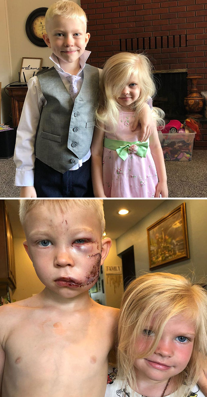 My Six-Year-Old Nephew Bridger Saved His Little Sister’s Life By Standing Between Her And A Charging Dog