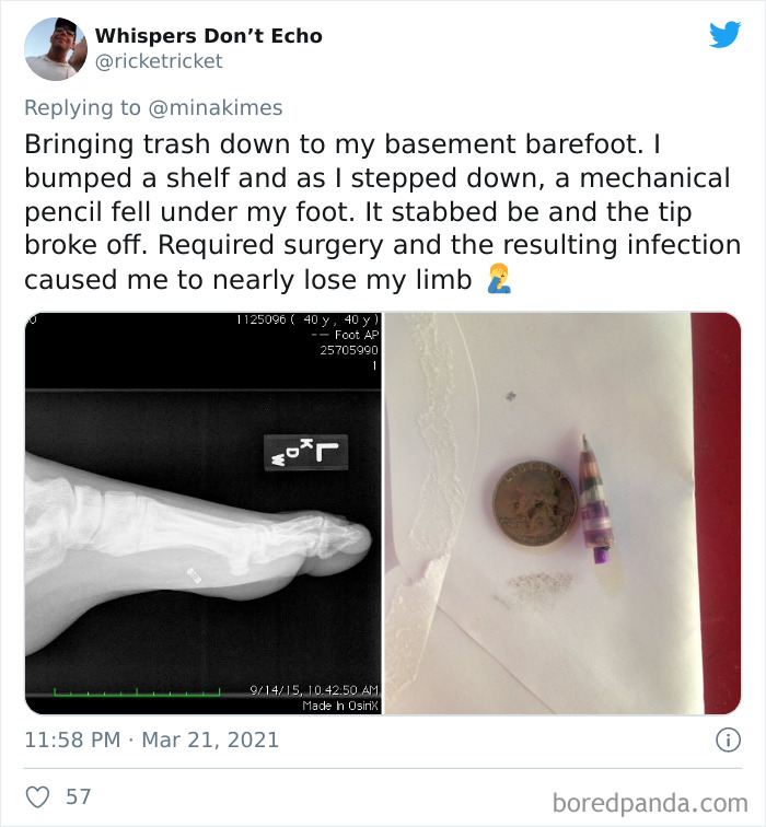 People-Share-Stupidest-Injury