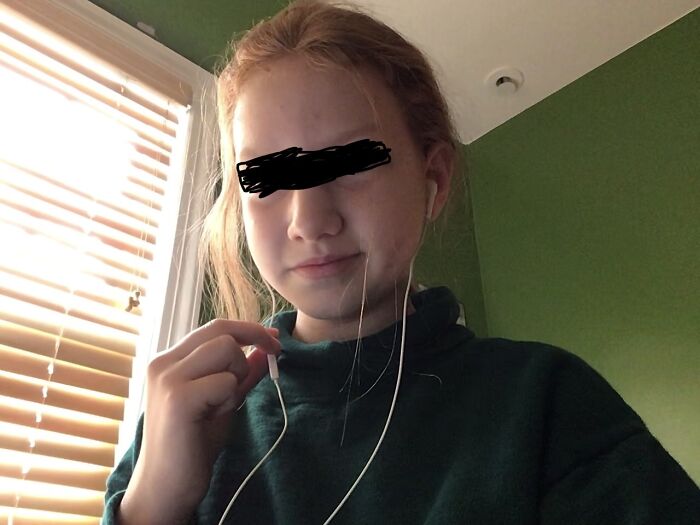Me ... I Blocked Out My Eyes Just Because :p Pls Excuse A C N E