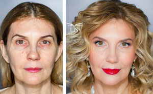 30 Before & After Pics Of This Makeup Artist's Clients That Shows The Power Of A Good Makeup Artist