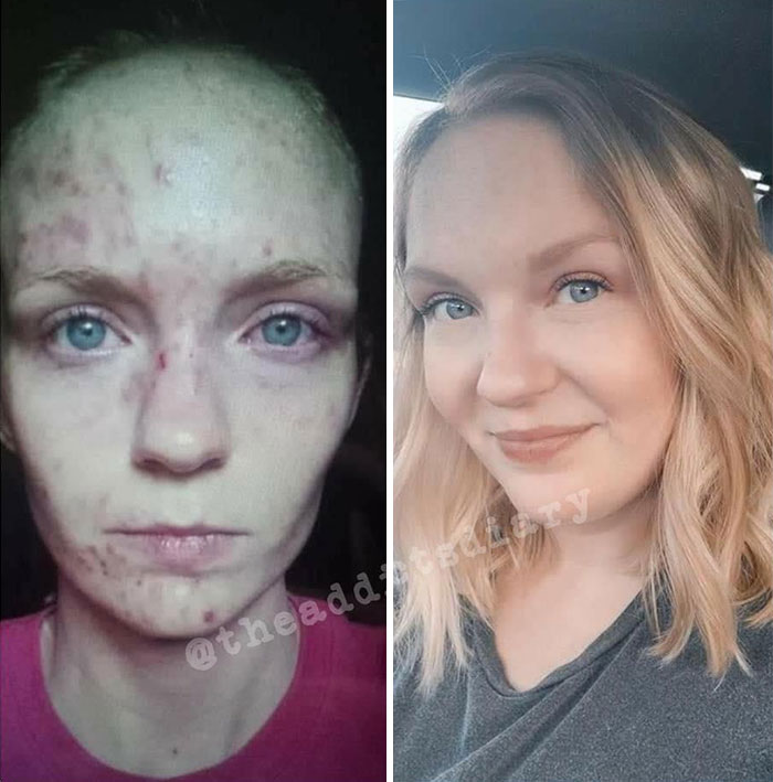 Before-After-Transformation-Stories-The-Addicts-Diary