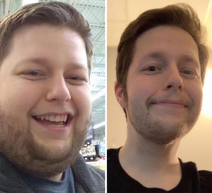 350 > 198 = 152lbs. (15 Months) I Lost 150 Pounds And Gained A Neck