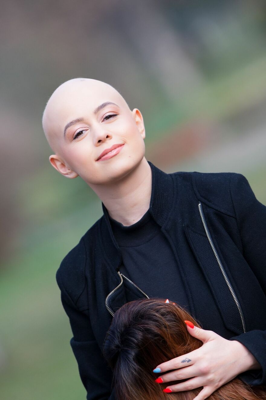 I Captured The Beautiful TV Reporter Who Decided To Embrace Her Alopecia