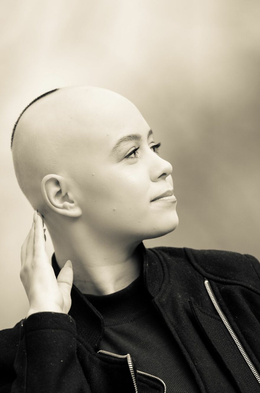 I Captured The Beautiful TV Reporter Who Decided To Embrace Her Alopecia