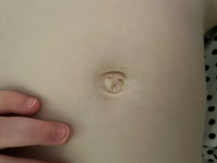 My Daughter’s Belly Button Has A Grumpy Old Lady In It!