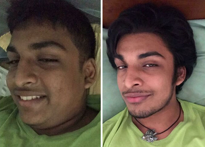 15 To 19. Same Shirt, Same Bed, Same Dude Haha. I’m Happy That My Nose Sorted Itself Out Somehow After My Brother Broke It