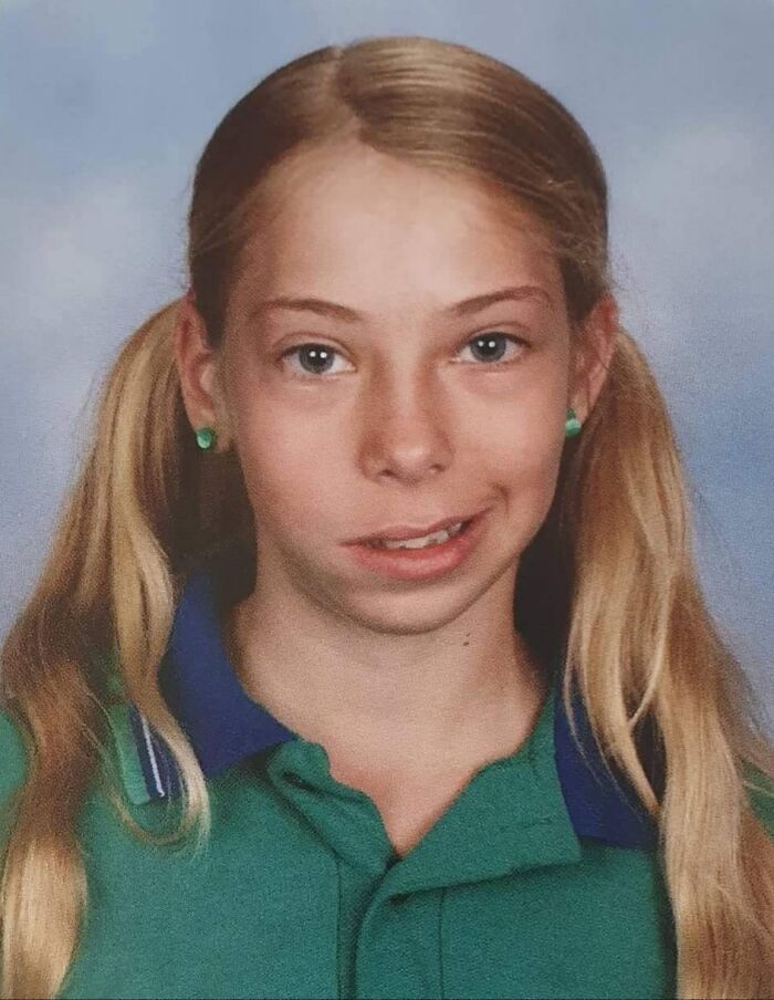 That Year My School Photos Fell On The Day I Had To Get 2 Teeth Removed
