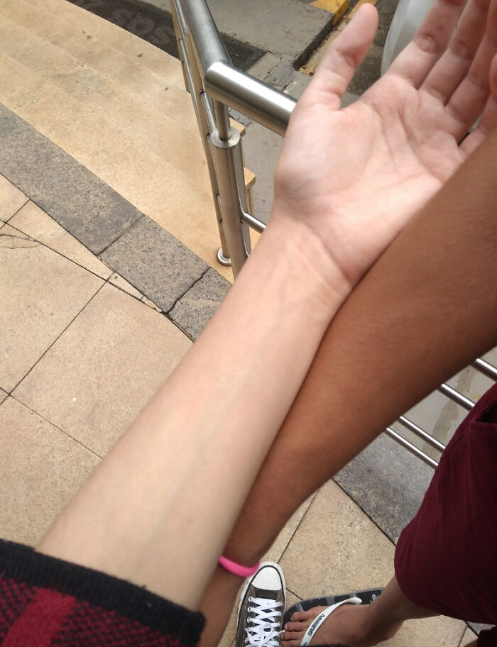 The Difference In Me And My Twin's Skin Color. He Goes Outside, I Don't