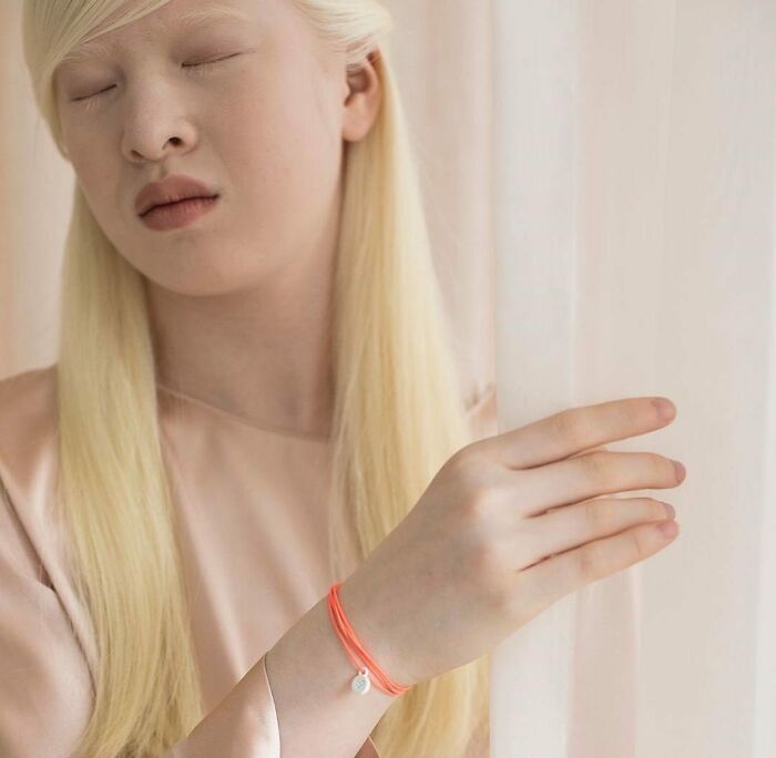 Xueli-Abbing-Chinese-Albino-Fashion-Model-Xueli-A