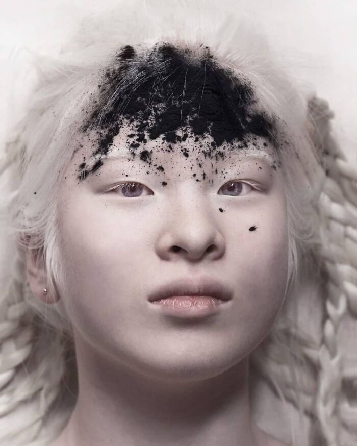 Abandoned As A Baby Due To Albinism, Xueli Grew Up To Become A Vogue Model (30 Pics)