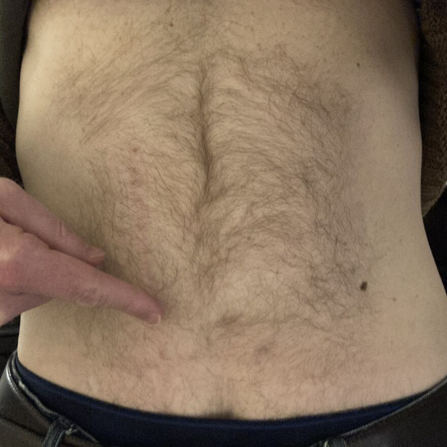 I Interview People About Their Scars I Interview People About Their Scars