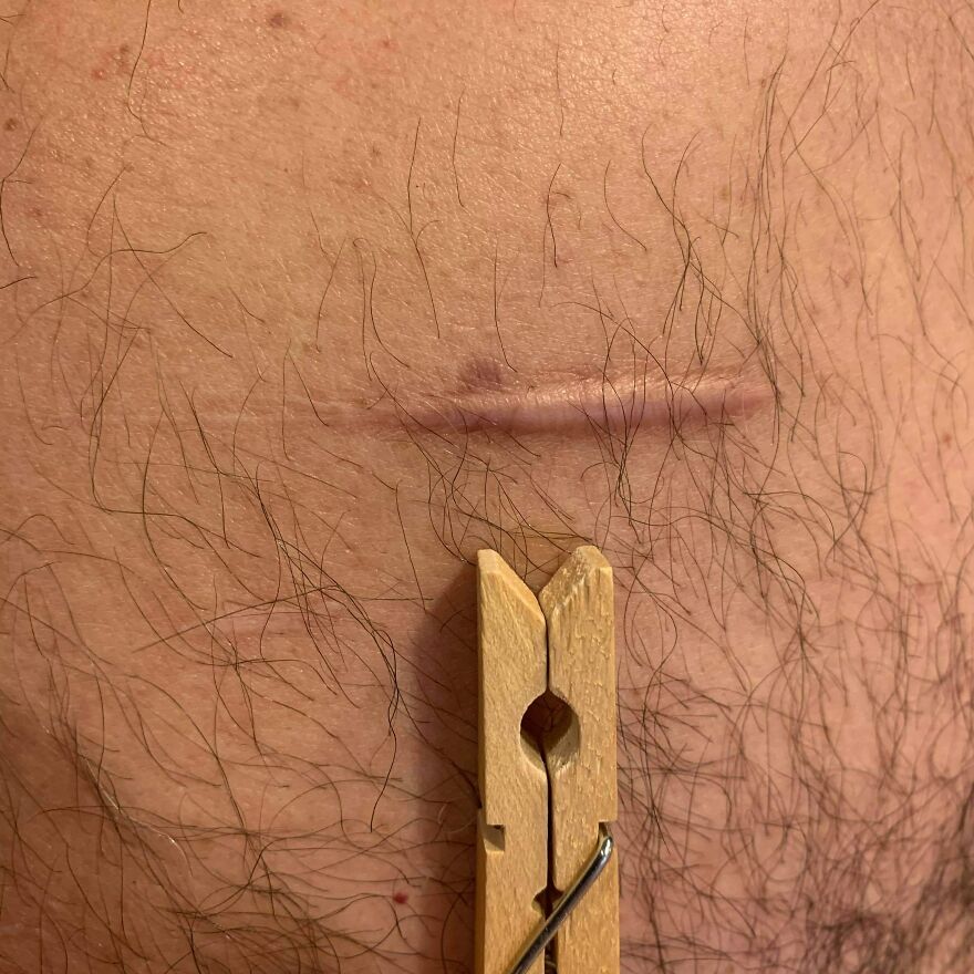 I Interview People About Their Scars I Interview People About Their Scars