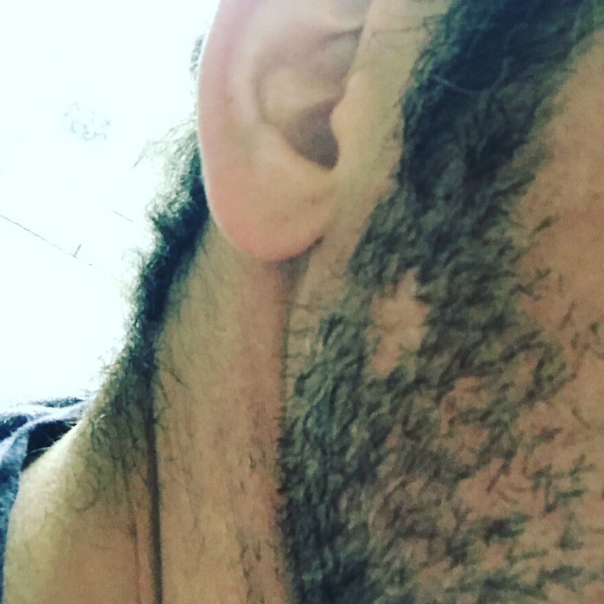 I Interview People About Their Scars I Interview People About Their Scars
