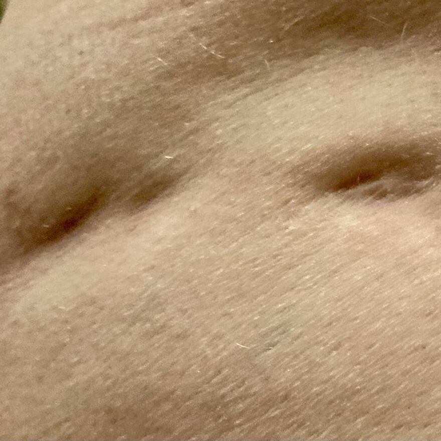 I Interview People About Their Scars I Interview People About Their Scars
